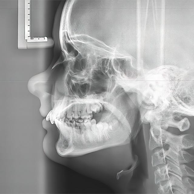 An x-ray of a skull