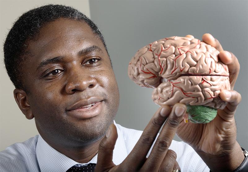 Chiadi Onyike博士的大脑模型
